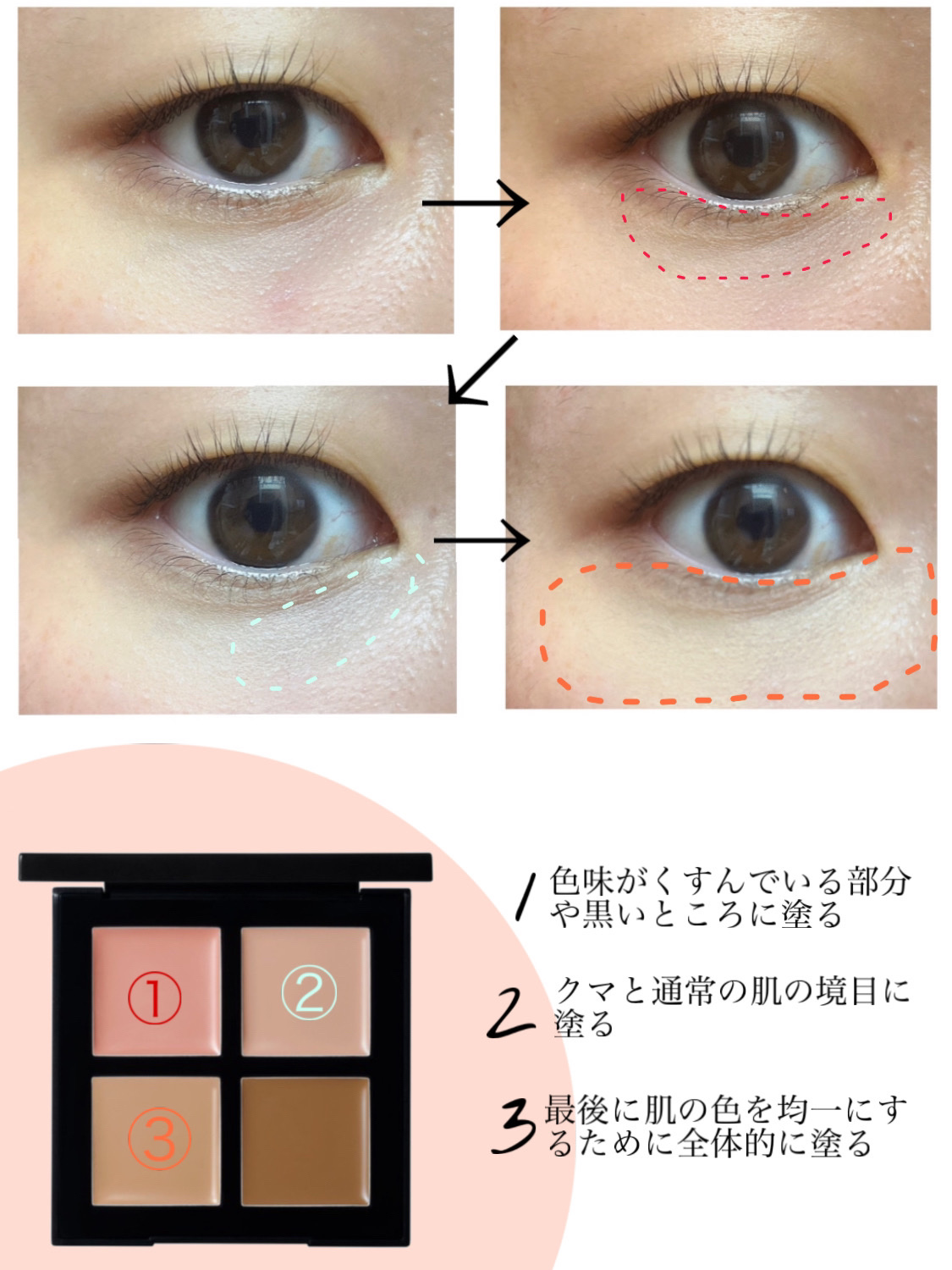 アンリミテッド CCC クワッド コンシーラー アンズ ピンク & クール ベージュ/shu uemura/パレットコンシーラーを使ったクチコミ（2枚目）