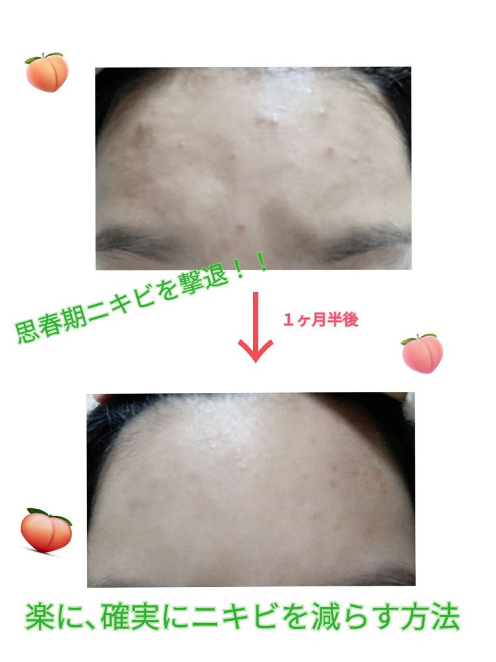 薬用洗顔フォーム/スキンライフ/洗顔フォームを使ったクチコミ（1枚目）