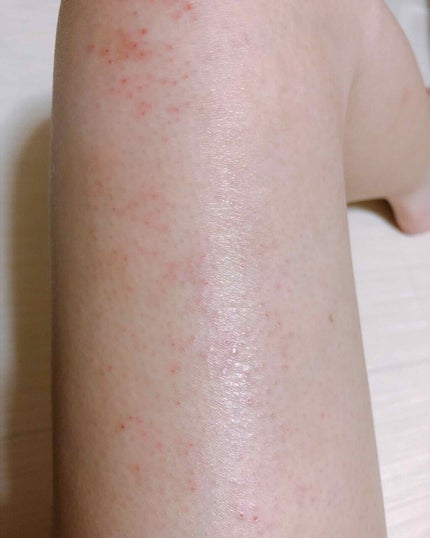 バスタイム除毛クリーム 敏感肌用/Veet/除毛クリームを使ったクチコミ(4枚目)