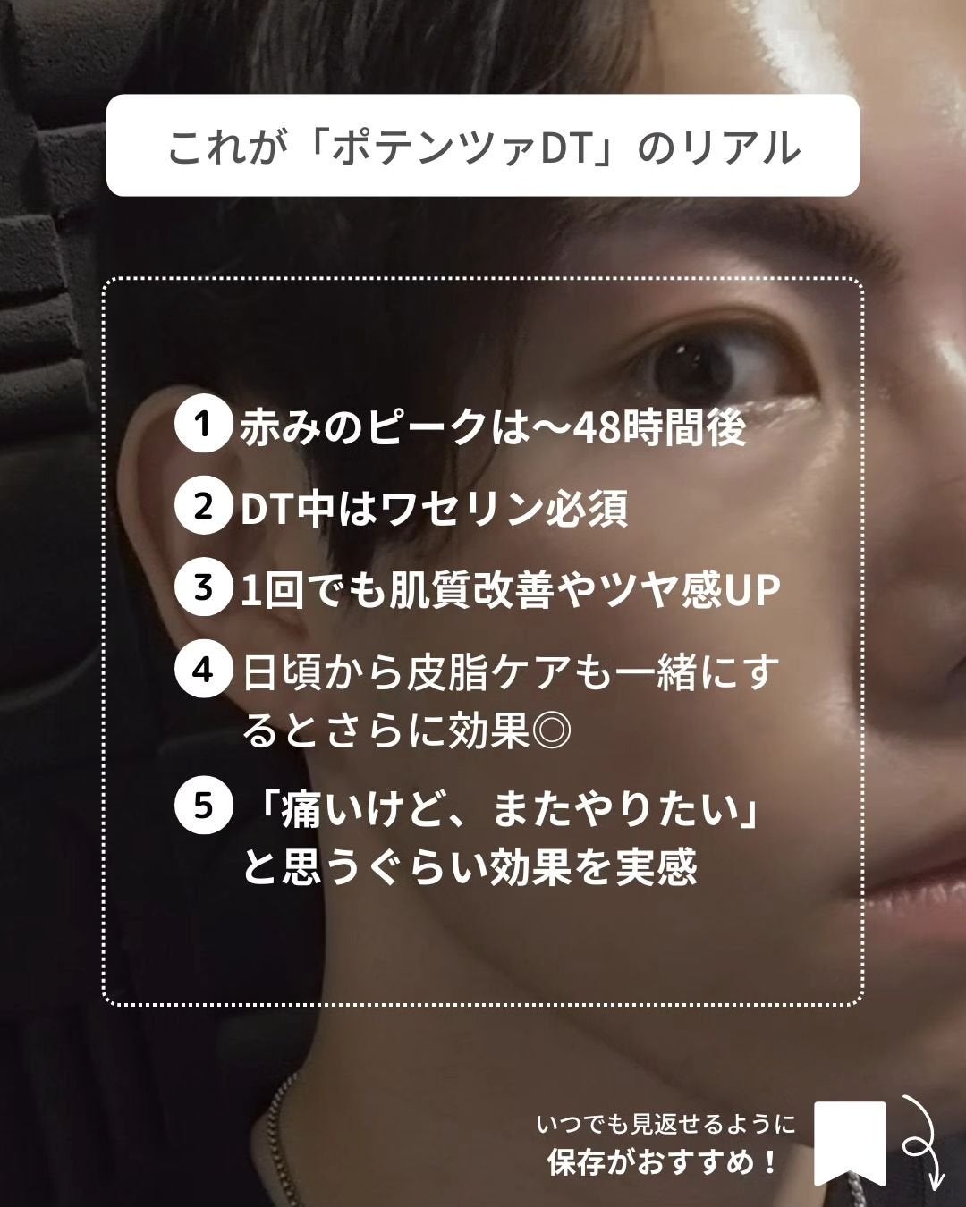 あき┃筋トレ美容家 on LIPS 「こんばんは、あきです!この前、人生初のポテンツァを受けてきまし..」(5枚目)