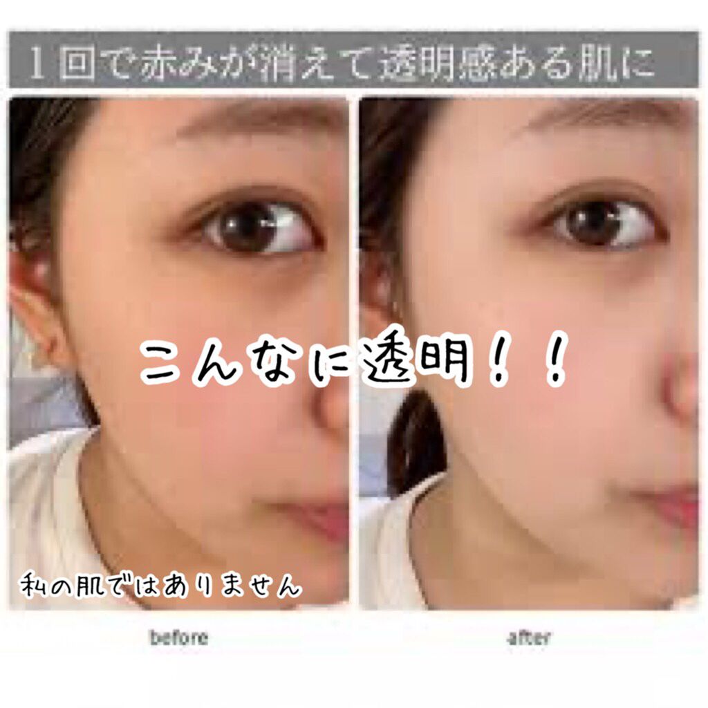 テラスキン/LINE REPAIR/美容液を使ったクチコミ（2枚目）