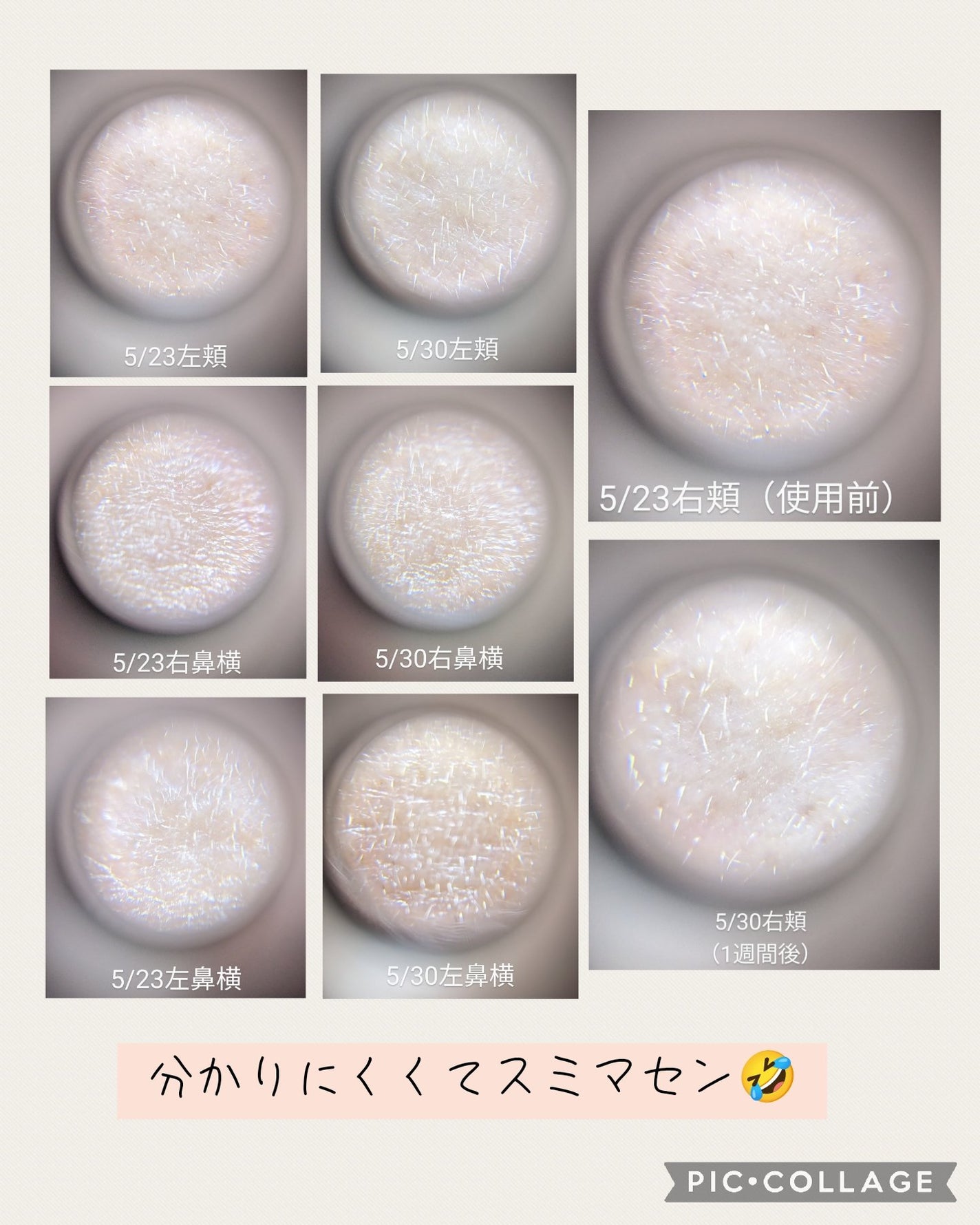 シカレチA エッセンス0.1/VT/美容液を使ったクチコミ(5枚目)