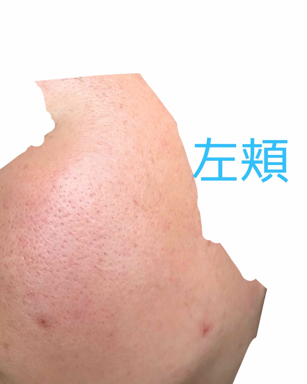 ハトムギ化粧水(ナチュリエ スキンコンディショナー R )/ナチュリエ/化粧水を使ったクチコミ(4枚目)