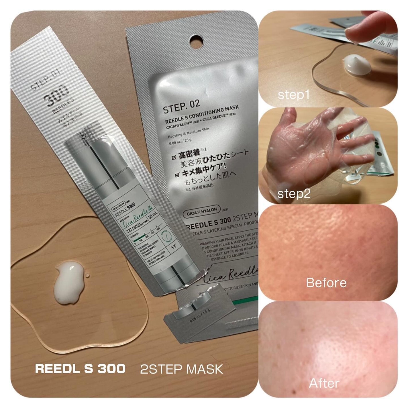 リードルS 100 2ステップマスク/VT/シートマスク・パックを使ったクチコミ(5枚目)