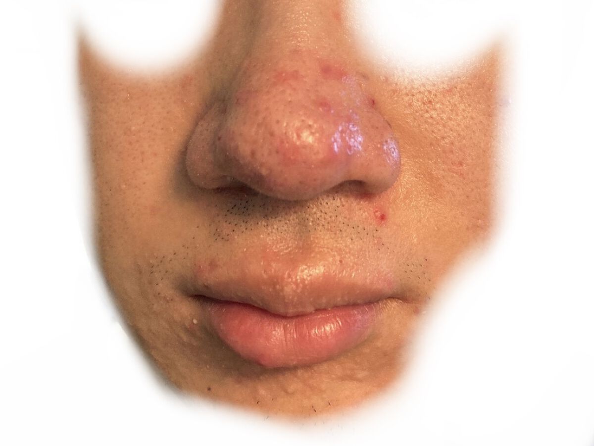 CICA デイリースージングマスク/VT/シートマスク・パックを使ったクチコミ（2枚目）