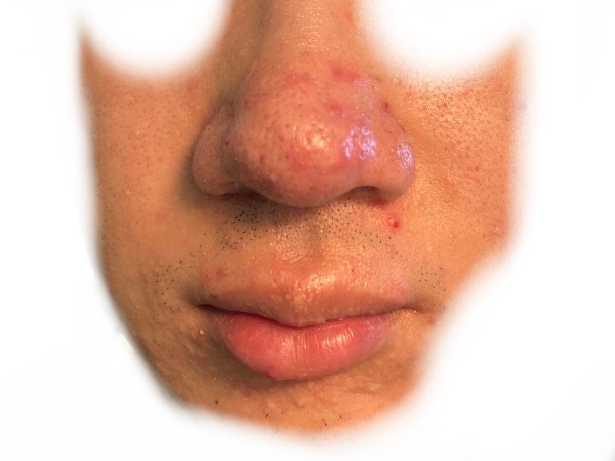 CICA デイリースージングマスク/VT/シートマスク・パックを使ったクチコミ(2枚目)