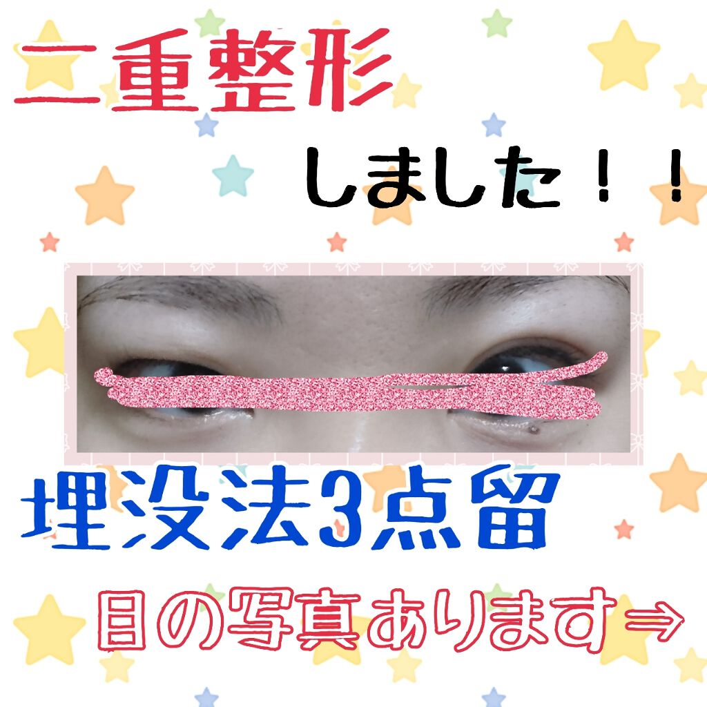 kyareeen(^-^) on LIPS ãðæŽåœ¢ã¬ãðããã«ã¡ã¯ïŒããã°ãã¯ïŒæ°ãã€ããããã©ãã¯ãŒæ§3..ãïŒ1æç®ïŒ