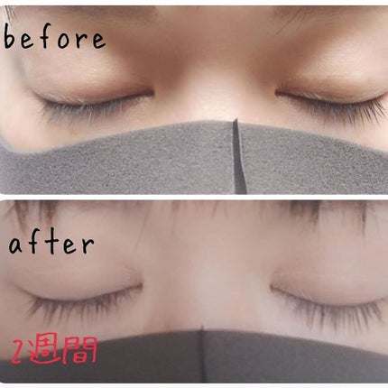 あたりちゃん♥️フォロバ&イイネ返し on LIPS 「【まつげ美容液トリカアイTrichoEye】1本でまつ毛美容液..」(6枚目)