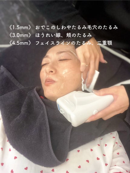 エミリー@フォロバ100 on LIPS 「・・脱毛・ハイフ・小顔・痩身 RAVIOS銀座店医療提携4Dハ..」(4枚目)