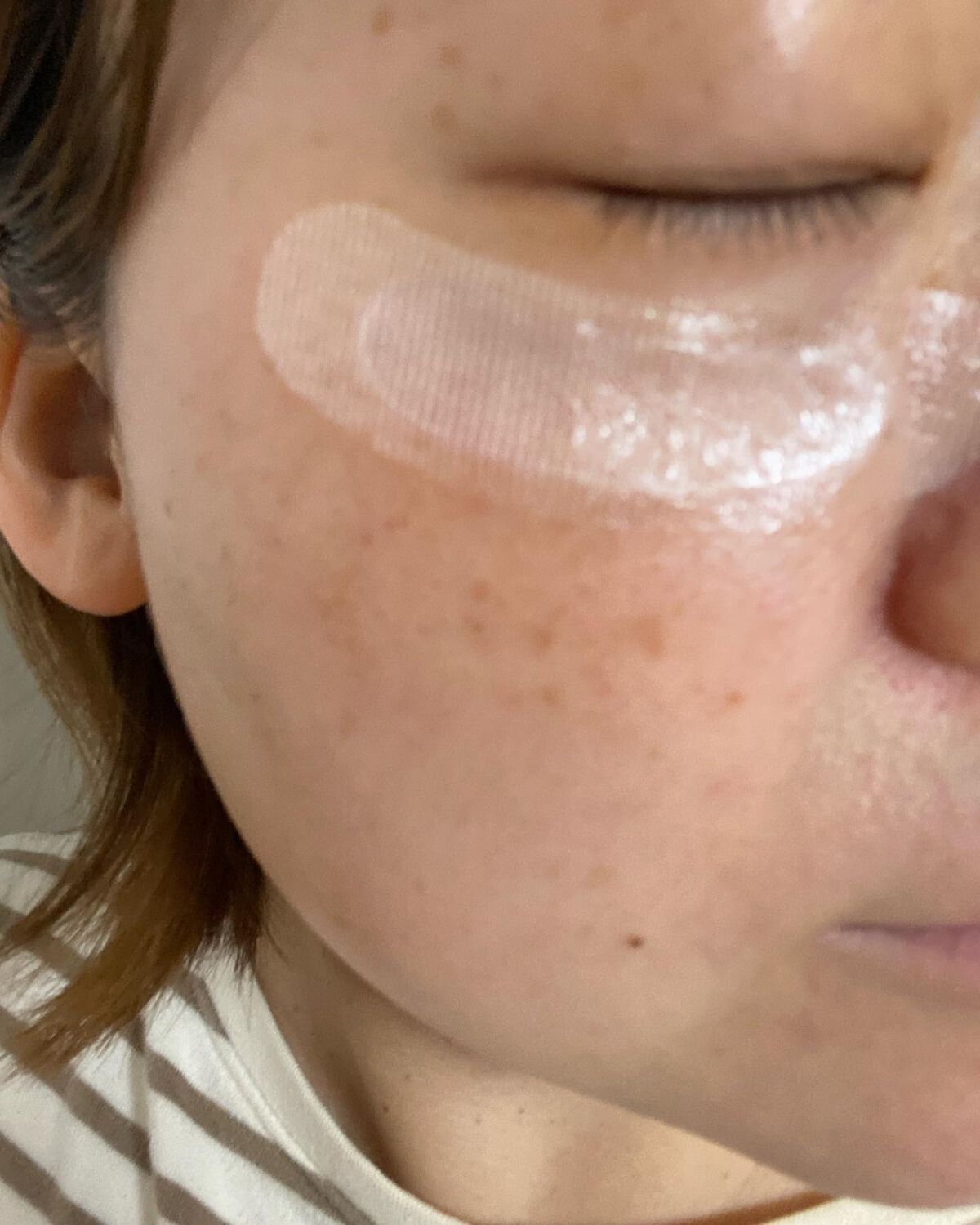 リクエス コンセントレート チャージ パッチ/クラブ/シートマスク・パックを使ったクチコミ(5枚目)