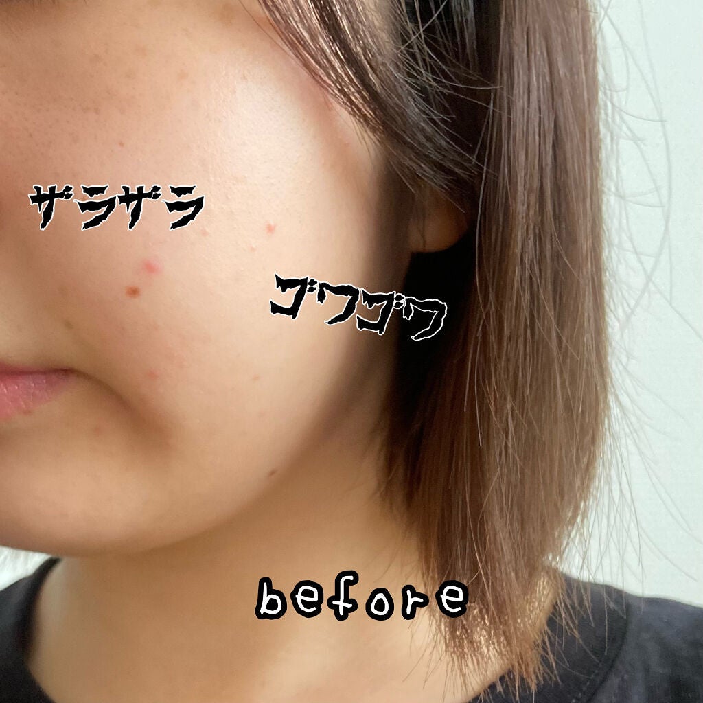 my's パーソナライズセラム/my's/美容液を使ったクチコミ(3枚目)