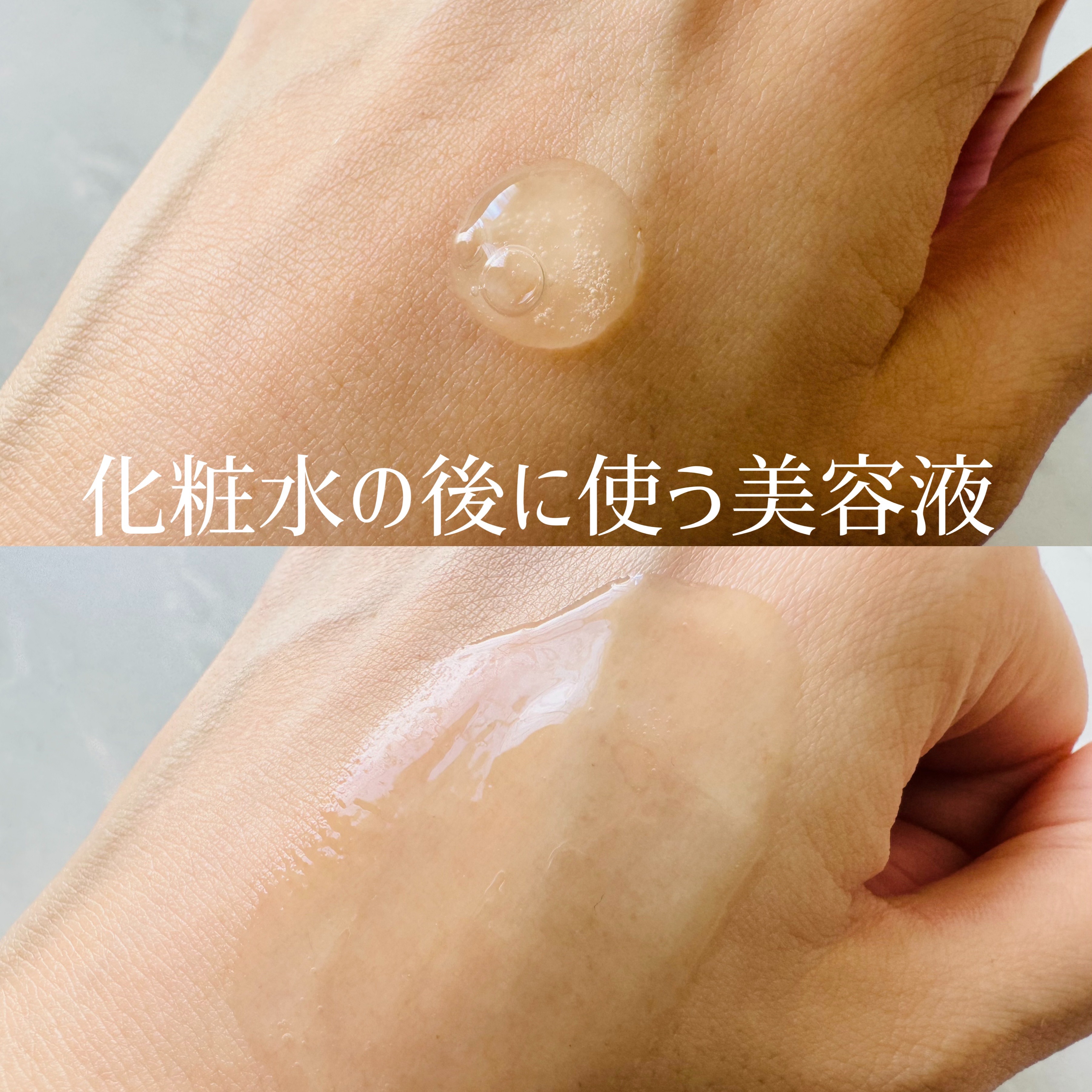 fractionalCC ニードルセラムC/fractionalCC/美容液を使ったクチコミ（2枚目）