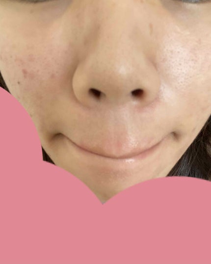 を使ったクチコミ(3枚目)