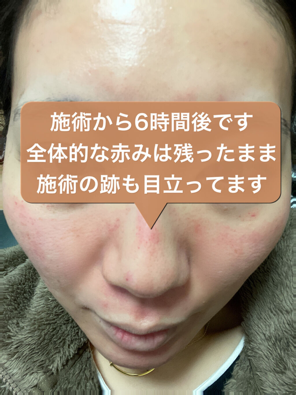 を使ったクチコミ（2枚目）