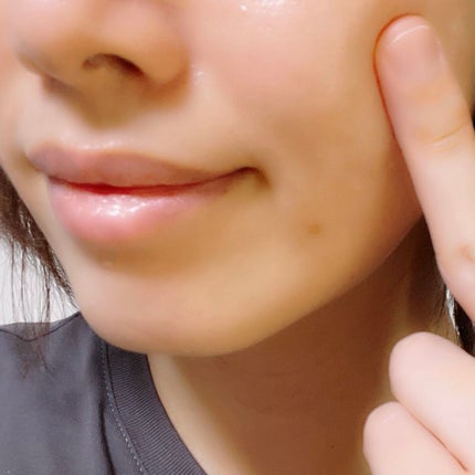 クリーム20/ドモホルンリンクル/フェイスクリームを使ったクチコミ(7枚目)