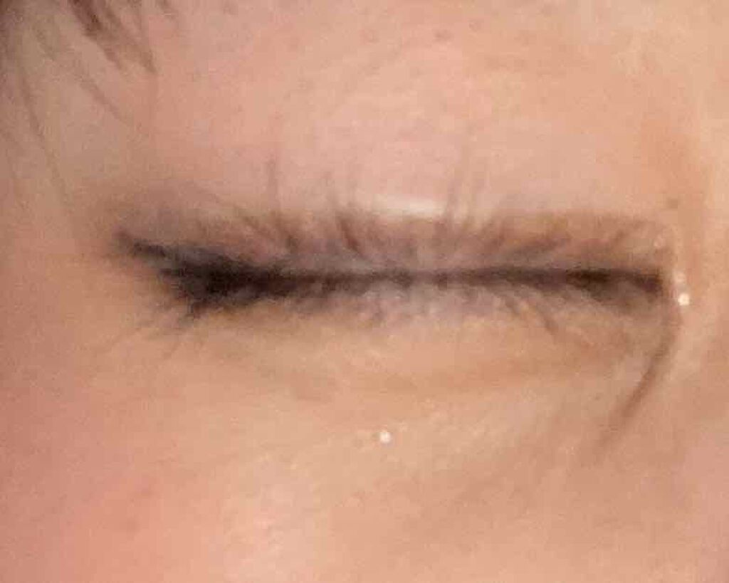 アイビューティー フィクサー WP/アストレア ヴィルゴ/二重まぶた用アイテムを使ったクチコミ（2枚目）