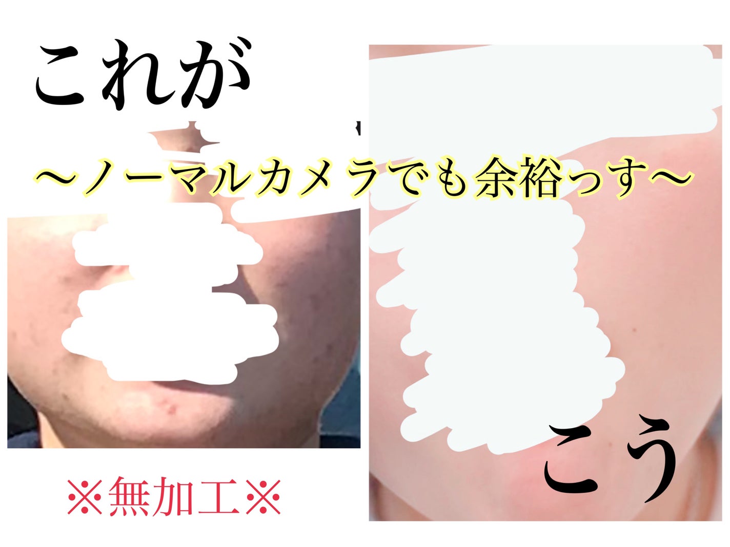 シカ メソッド クリーム/コジット/フェイスクリームを使ったクチコミ(1枚目)