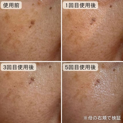 ポアタイトニングブーストセラム/CELORABY/美容液を使ったクチコミ(7枚目)