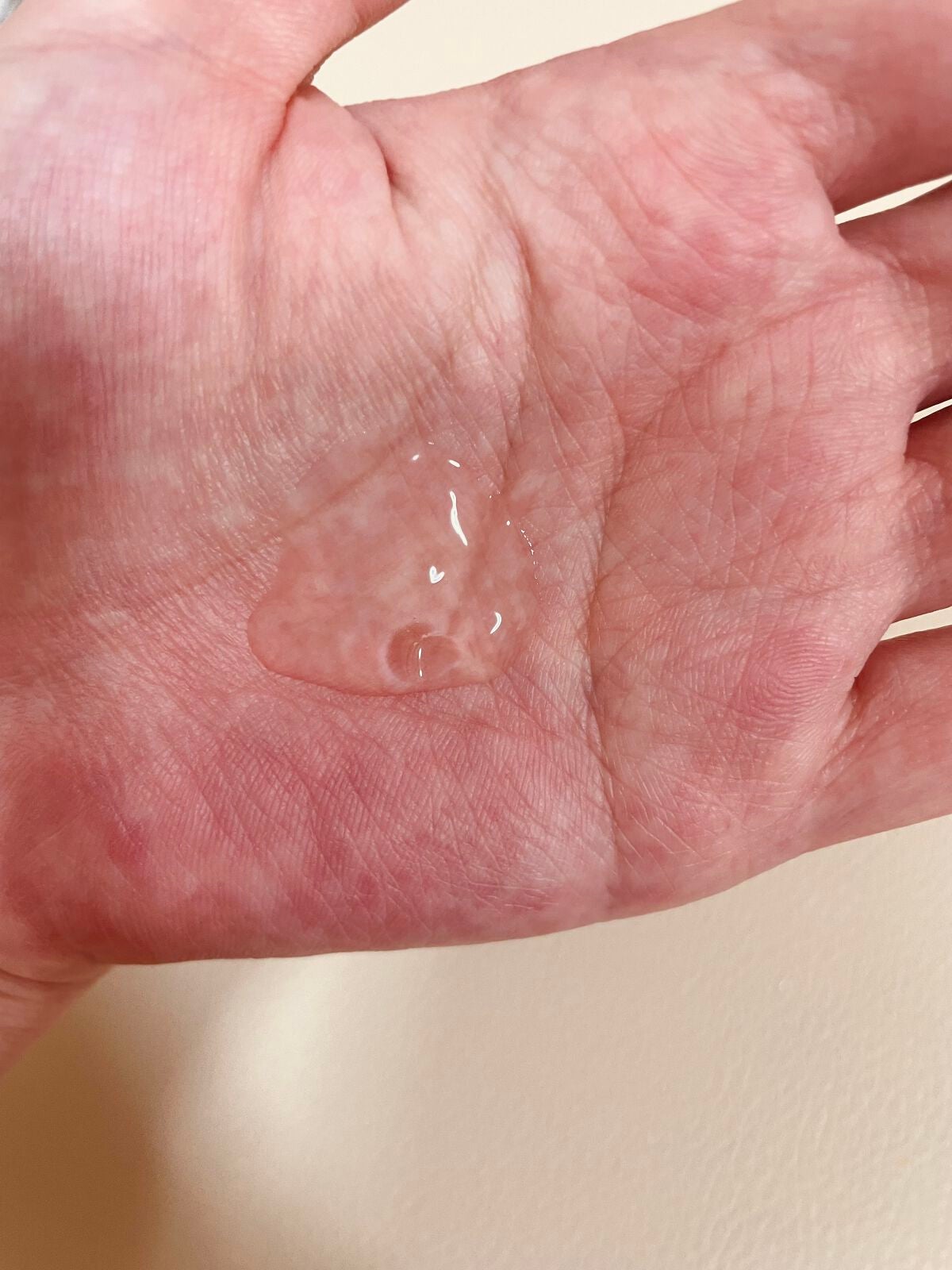 ビタミンCセラム/ADVANCED CLINICALS/美容液を使ったクチコミ(3枚目)