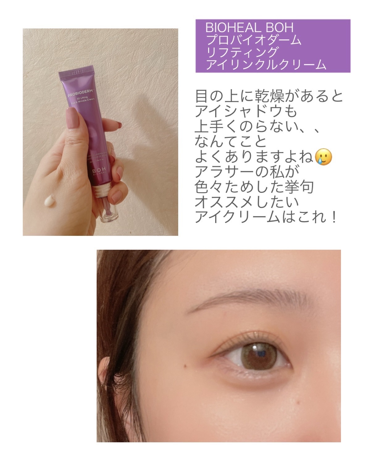 プロバイオダーム リフティング アイリンクルクリーム/BIOHEAL BOH/アイケア・アイクリームを使ったクチコミ（1枚目）