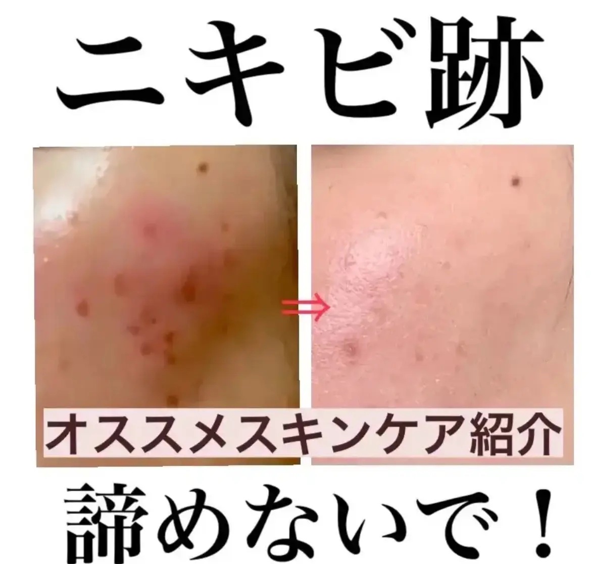 クリアフル ローションL(さっぱりタイプ)/オルビス/化粧水を使ったクチコミ（1枚目）