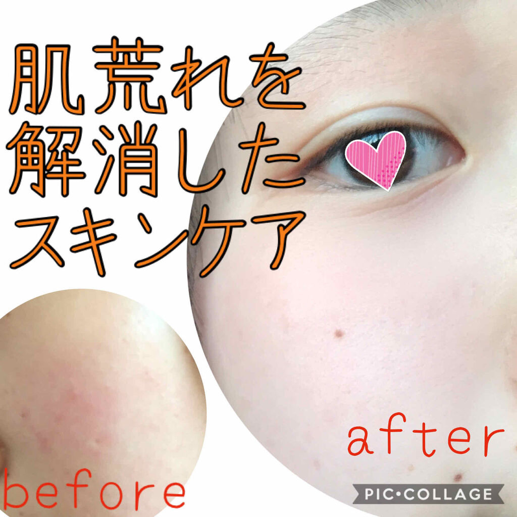 白潤 薬用美白乳液/肌ラボ/乳液を使ったクチコミ（1枚目）