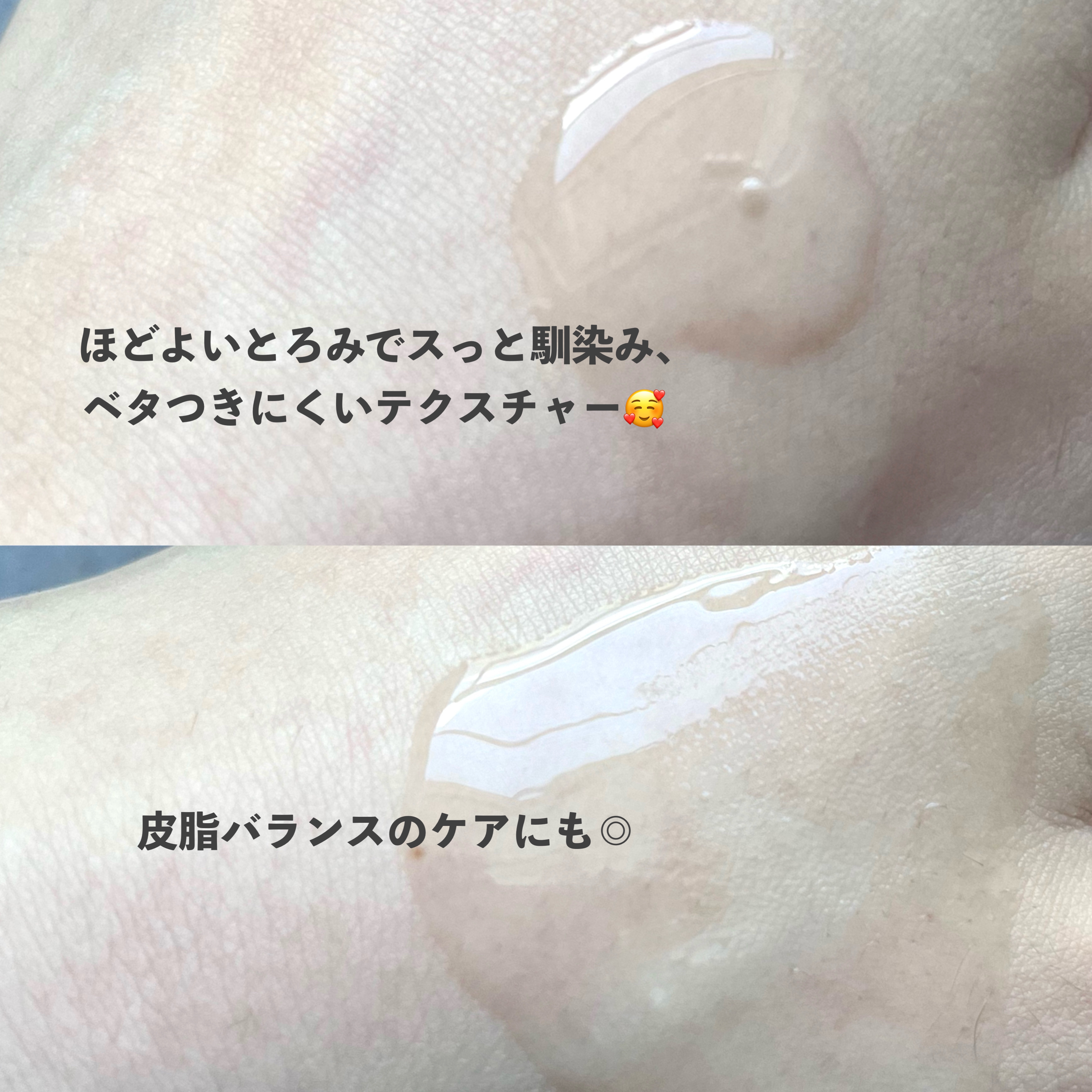 ノスカナイン トラブル セラム/FATION/美容液を使ったクチコミ（3枚目）