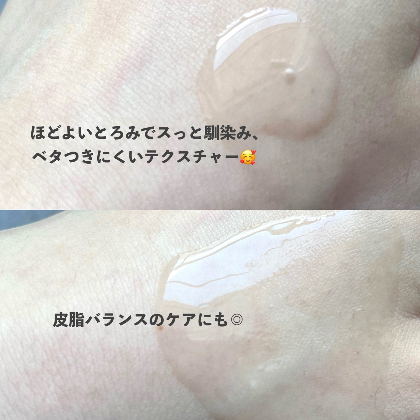 ノスカナイン トラブル セラム/FATION/美容液を使ったクチコミ(3枚目)