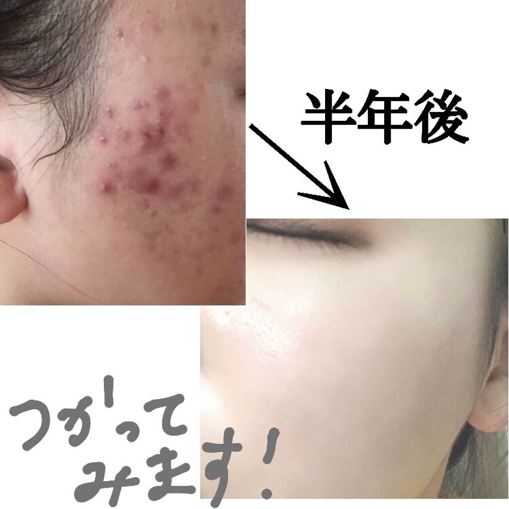 CICA クリーム/VT/フェイスクリームを使ったクチコミ（1枚目）