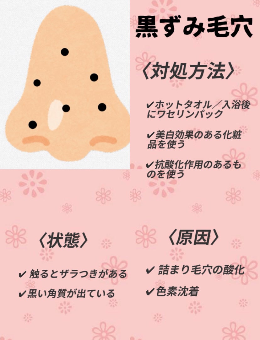 CocoNa/フォロバ100% on LIPS 「 \〜あなたの毛穴は何タイプ?〜/ 毛穴の種類..」(2枚目)