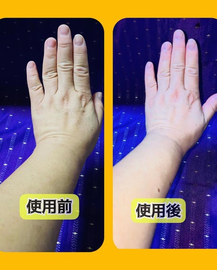 薬用ホワイトコンク ボディシャンプーC II/ホワイトコンク/ボディソープを使ったクチコミ(8枚目)