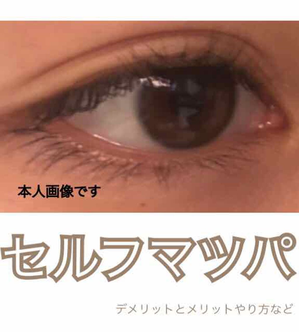 ローヤルゼリー配合 栄養ローション/DAISO/美容液を使ったクチコミ（1枚目）