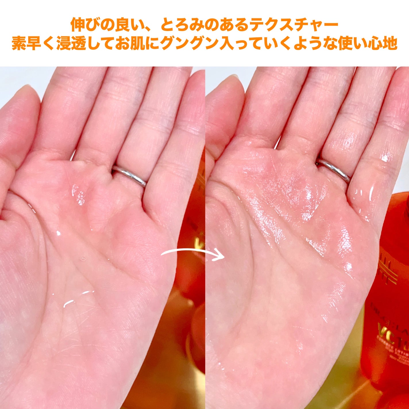 VC100エッセンスローション EX/ドクターシーラボⓇ/化粧水を使ったクチコミ(3枚目)