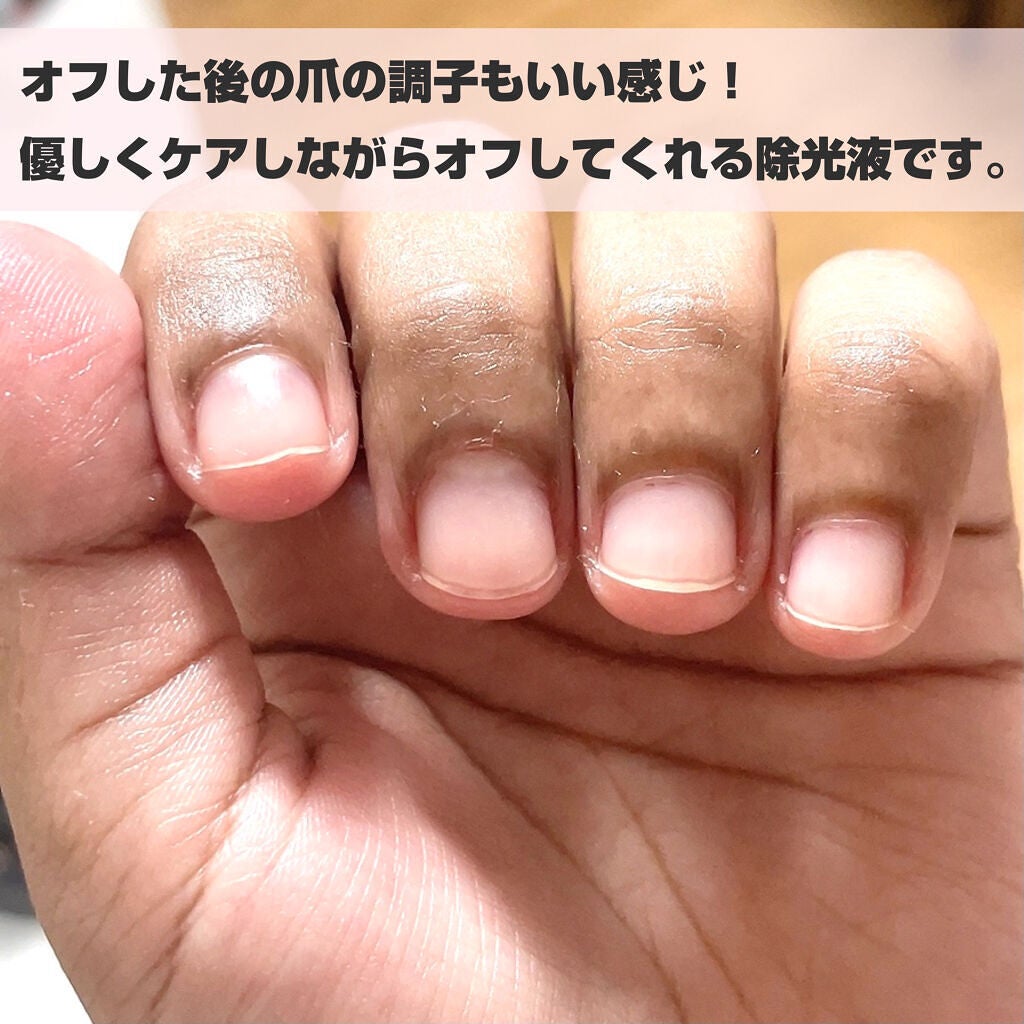 トリートメントネールリムーバー N/インテグレート/除光液を使ったクチコミ(5枚目)