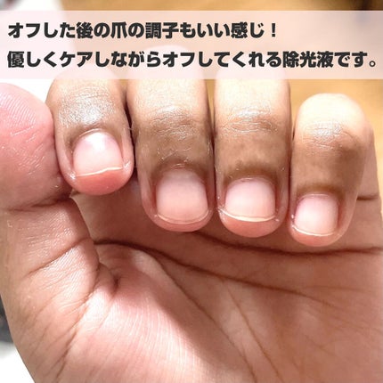 トリートメントネールリムーバー N/インテグレート/除光液を使ったクチコミ(5枚目)