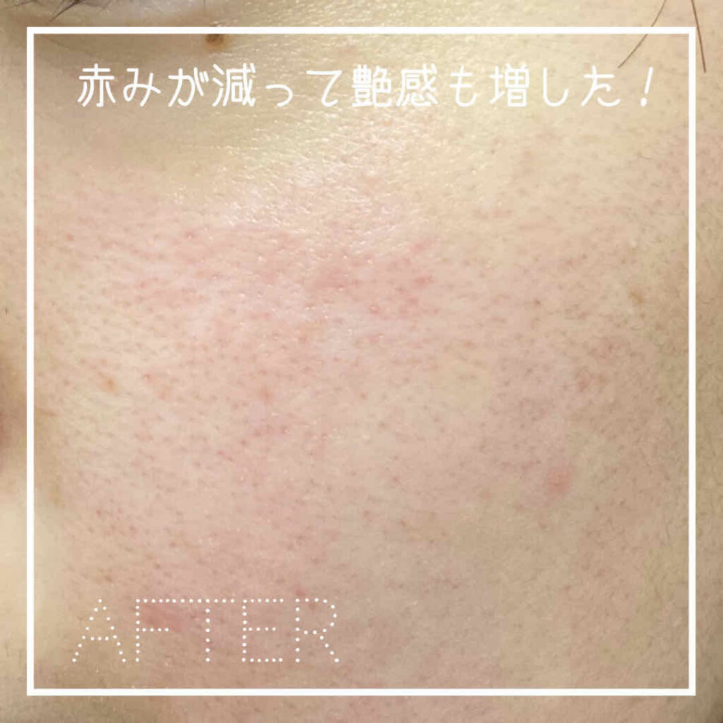 MEDIHEAL I.P.IライトマックスAPマスクEXのクチコミ「透明感と艶感が欲しいならメディヒール！
メディヒールi.p.iのレビューです！

メディヒール.....」（3枚目）