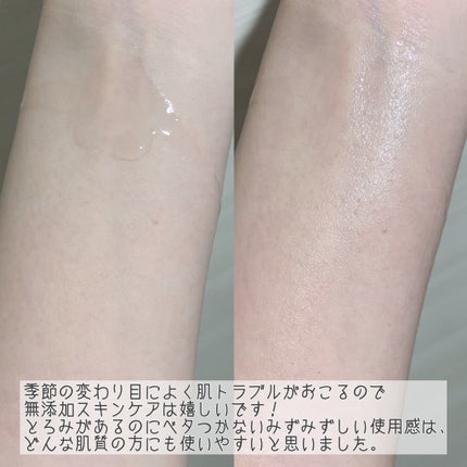 トイロ バランシングドロップ<医薬部外品>(化粧液)/ファンケル/化粧水を使ったクチコミ(5枚目)