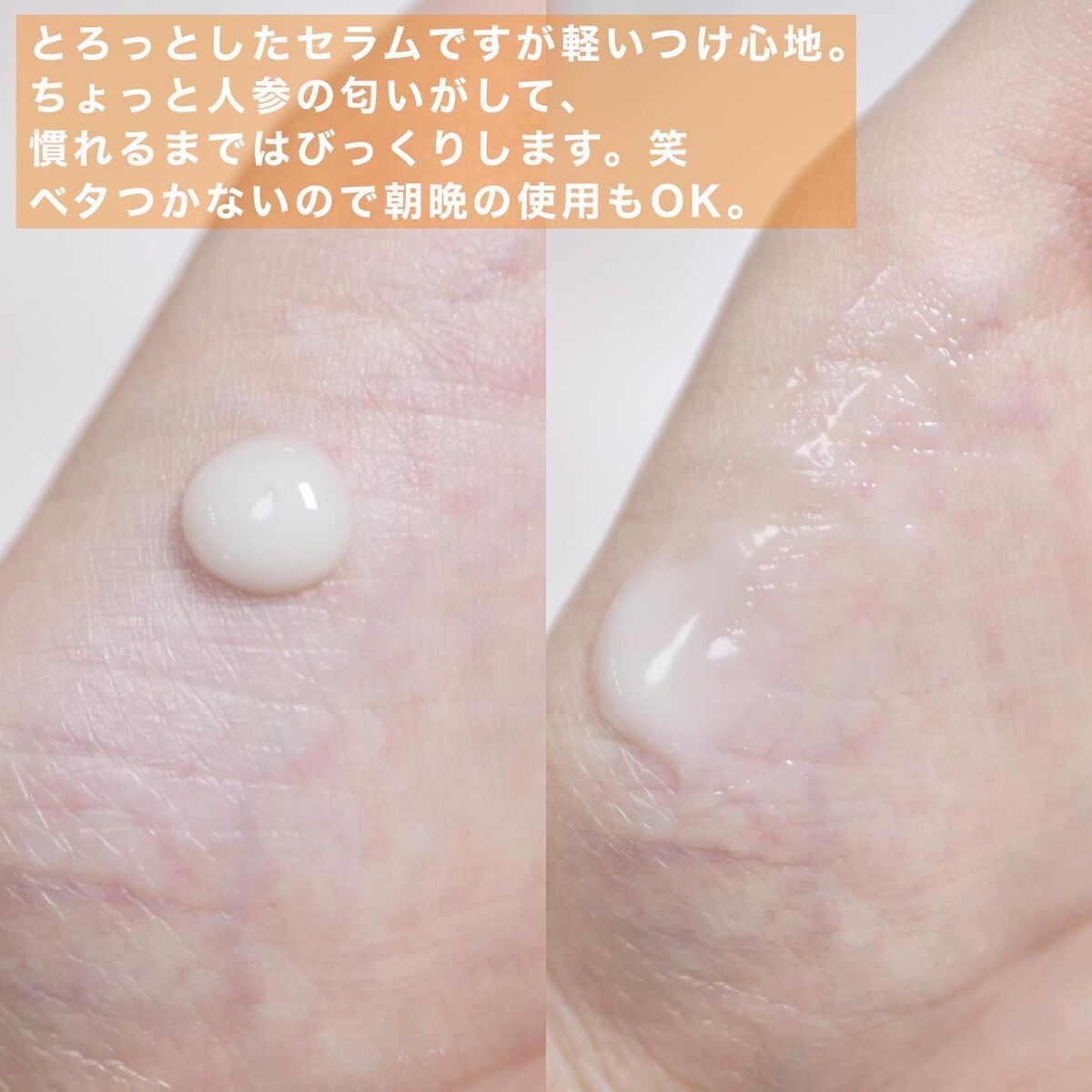 リアルカロテンブレミッシュクリアセラム/APRILSKIN/美容液を使ったクチコミ(3枚目)