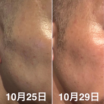 CICA デイリースージングマスク/VT/シートマスク・パックを使ったクチコミ(2枚目)