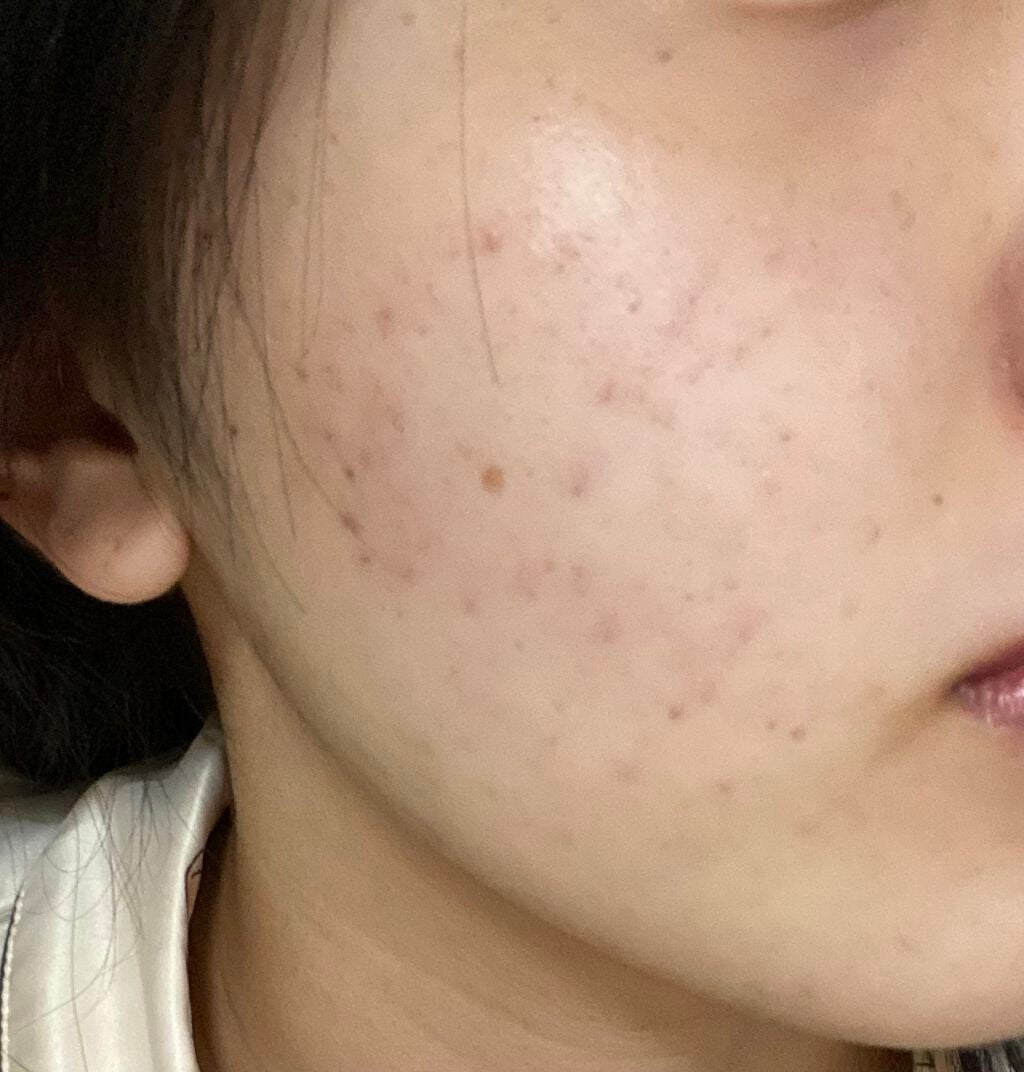 なっちゃん on LIPS 「デュアックの女でーす全然投稿してなかったー💦最近は全然デュアッ..」(3枚目)