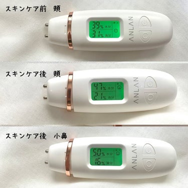 スキンチェッカー/ANLAN/美顔器・マッサージを使ったクチコミ（3枚目）