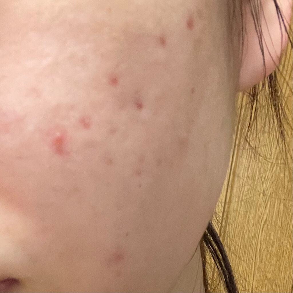 ð¥ºð€ on LIPS ããããè·¡ã«ã€ããŠããã¯ãèµ€ã¿ã§ããïŒè²çŽ æ²çã§ããïŒãŸãããã..ãïŒ1æç®ïŒ