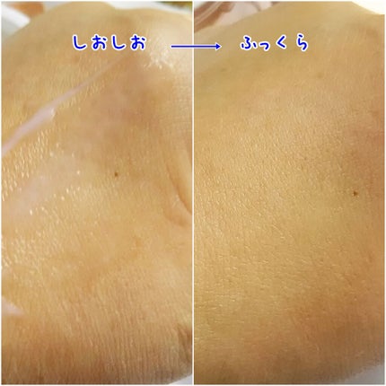 パーフェクトワン 薬用リンクルストレッチジェル/パーフェクトワン/オールインワン化粧品を使ったクチコミ(3枚目)