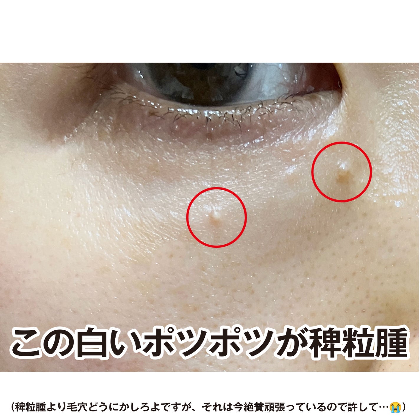 ピュアベール(医薬品)/プロペト/その他を使ったクチコミ(2枚目)