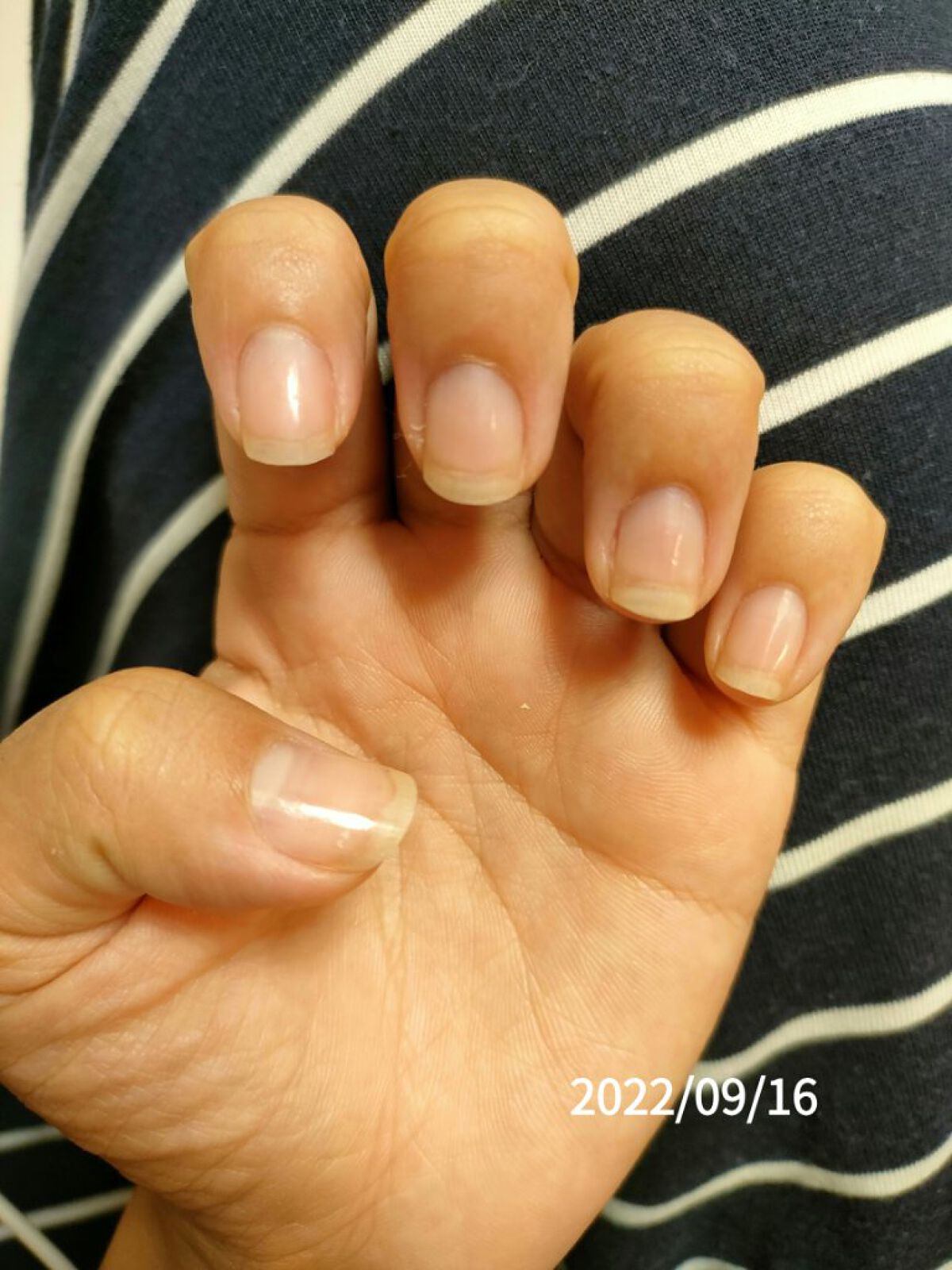 ナイトケア手袋/DAISO/ボディグッズを使ったクチコミ（1枚目）