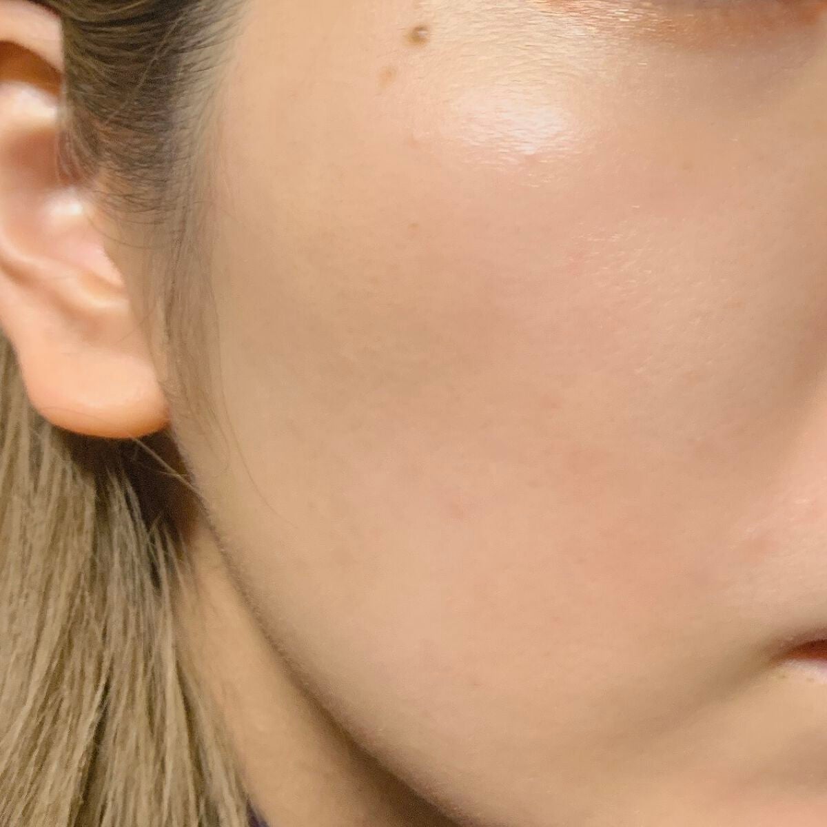 ちゃぼ on LIPS 「肌治安メモ今回から外カメラで撮影します!☀︎朝水洗顔メディヒー..」(1枚目)