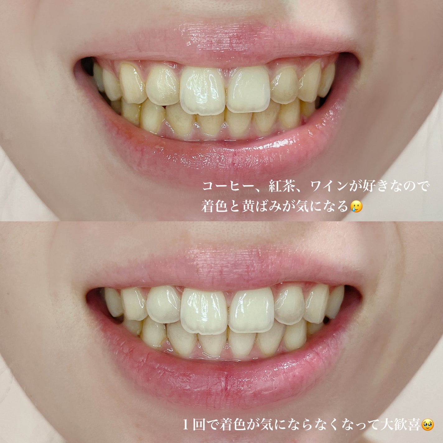 ビュッセン 歯磨き粉 28 /VUSSEN/歯磨き粉を使ったクチコミ(4枚目)