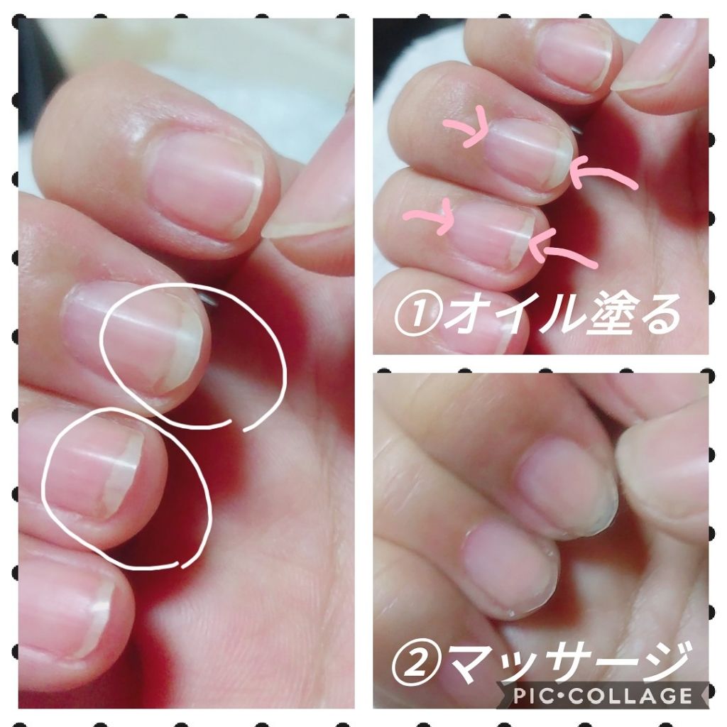 キューティクルオイル/ネイルホリック/ネイルオイル・トリートメントを使ったクチコミ(3枚目)