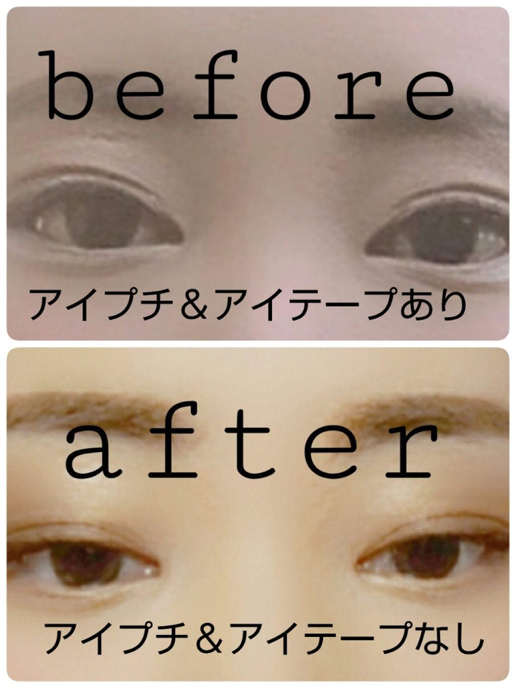 アイトーク/アイトーク/二重まぶた用アイテムを使ったクチコミ(2枚目)