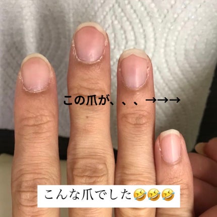 キューティクルオイル/HOMEI/ネイルオイル・トリートメントを使ったクチコミ(4枚目)
